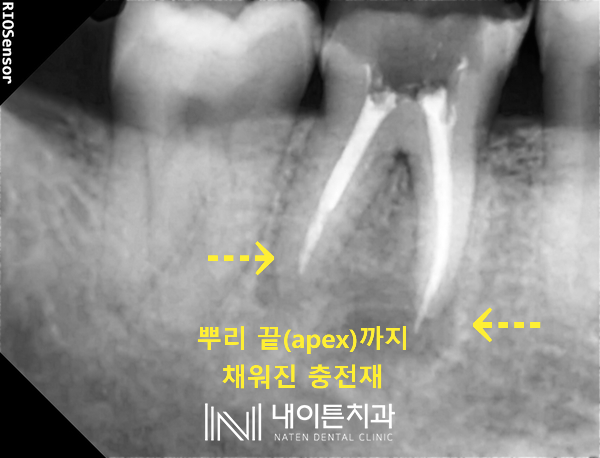 Treatment case image 4
