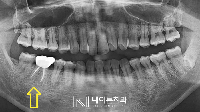Treatment case image 7