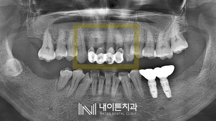 Treatment case image 1