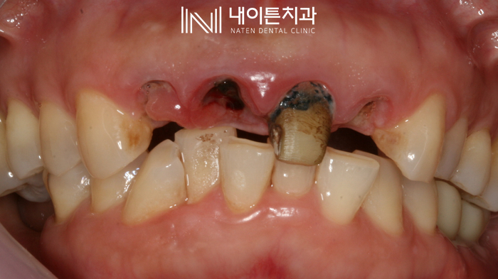 Treatment case image 2