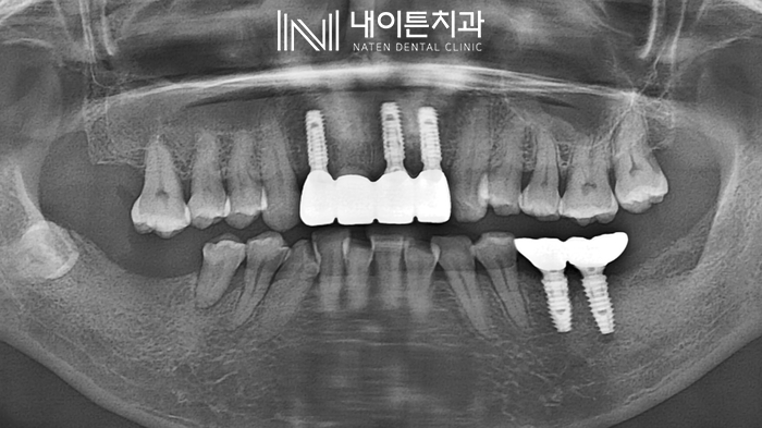 Treatment case image 3