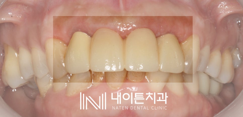 Treatment case image 4