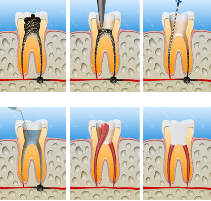 Treatment case image 1