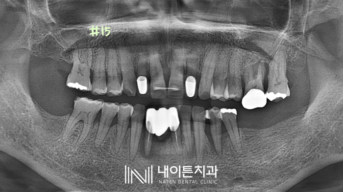 Treatment case image 1