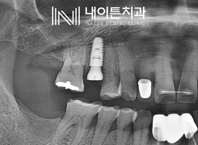 Treatment case image 7