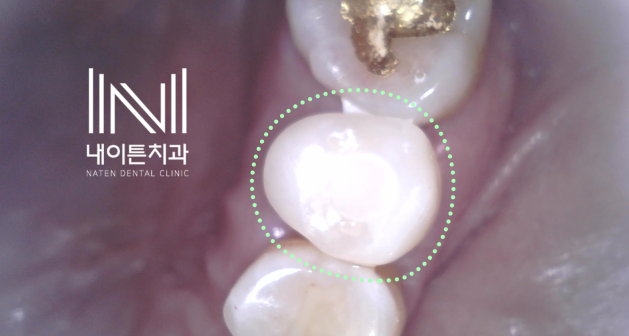 Treatment case image 8