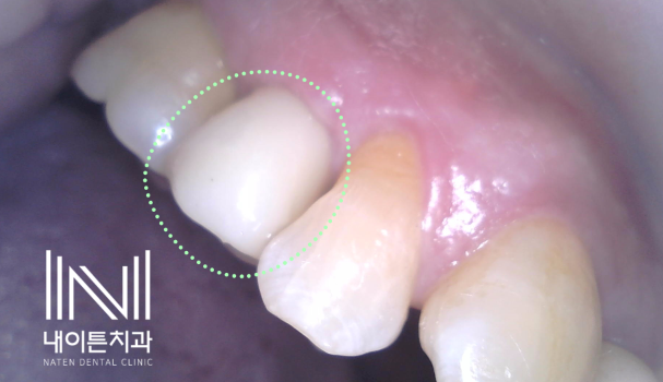 Treatment case image 9