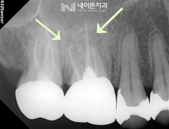 Treatment case image 1