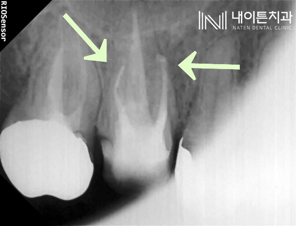 Treatment case image 4