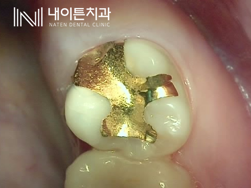 Treatment case image 1