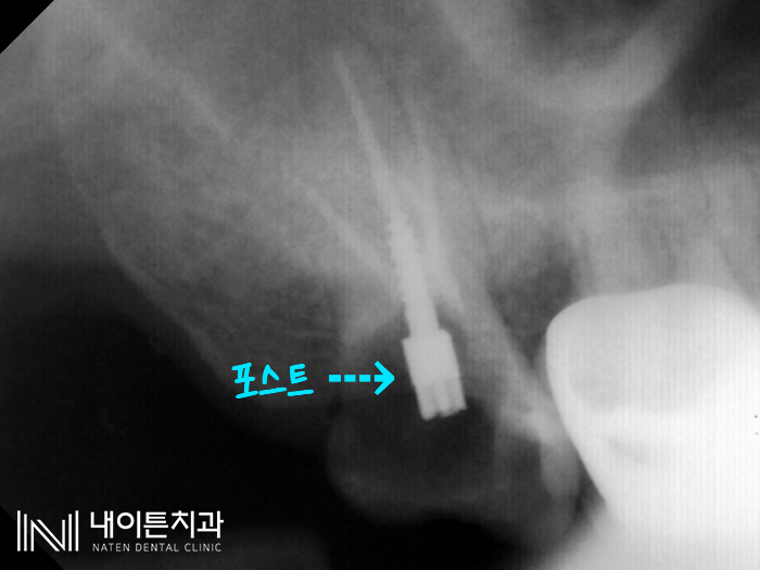Treatment case image 10