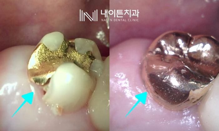 Treatment case image 16