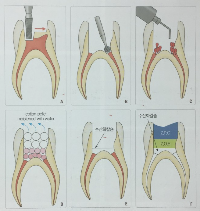 Treatment case image 1
