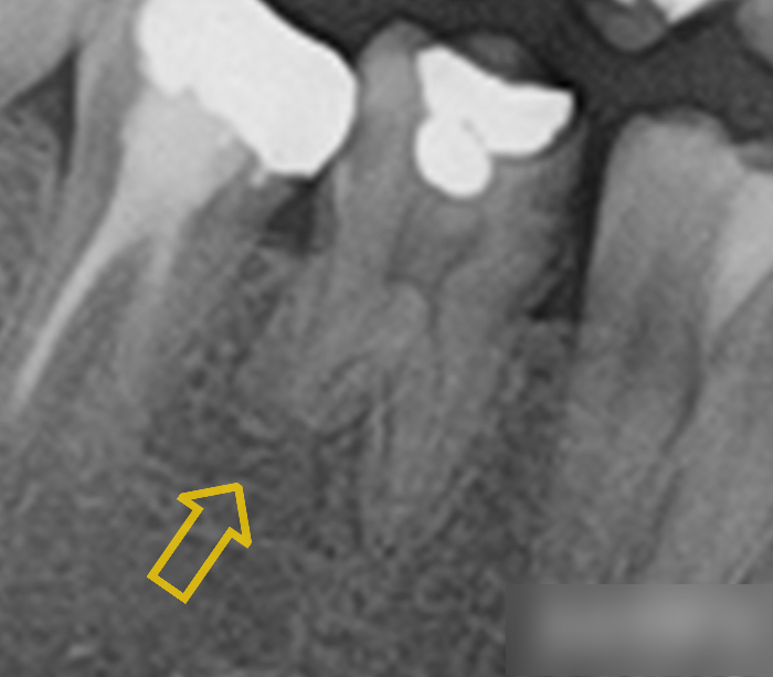 Treatment case image 2
