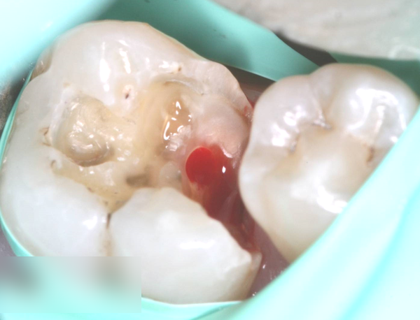 Treatment case image 4