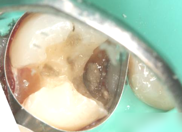 Treatment case image 6