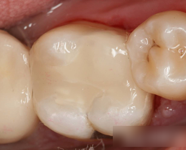 Treatment case image 13