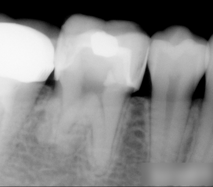 Treatment case image 14