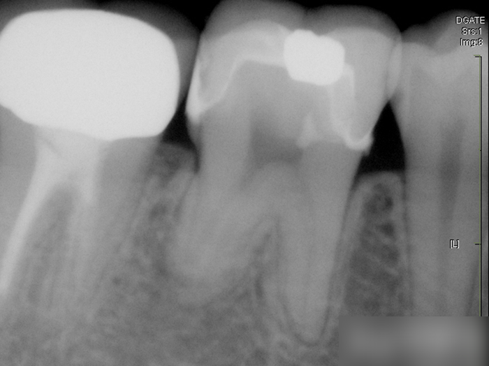 Treatment case image 15