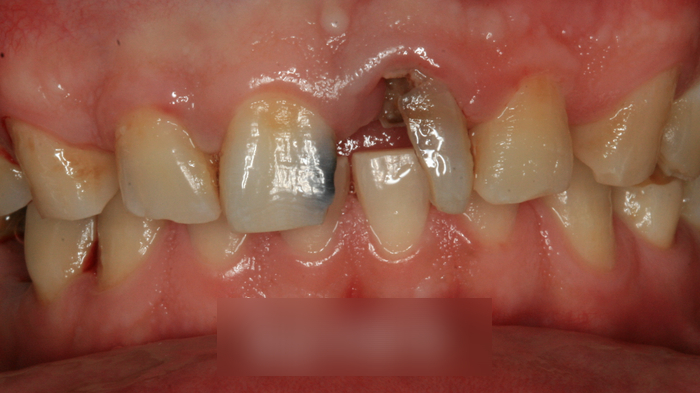 Treatment case image 1
