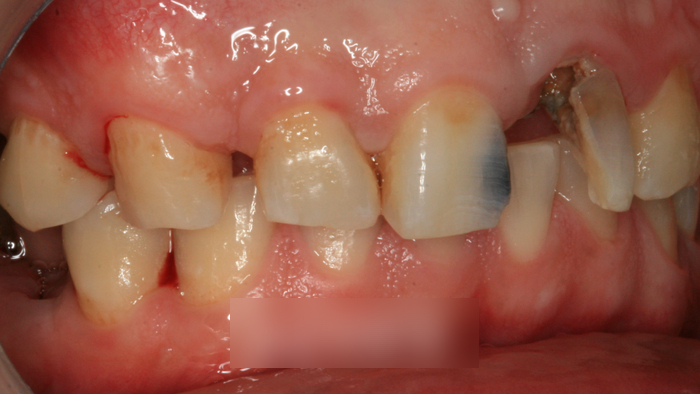 Treatment case image 2