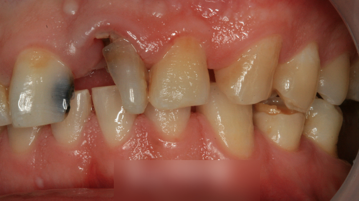 Treatment case image 3