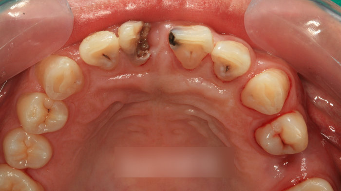Treatment case image 4