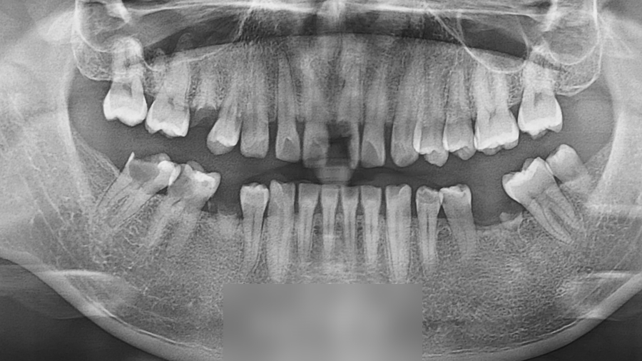 Treatment case image 5