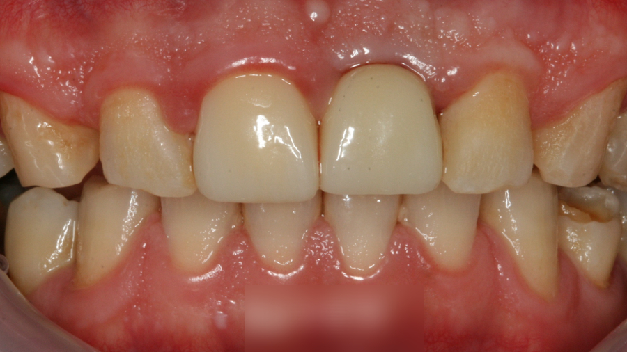 Treatment case image 9