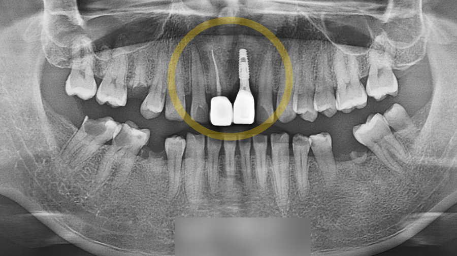 Treatment case image 10