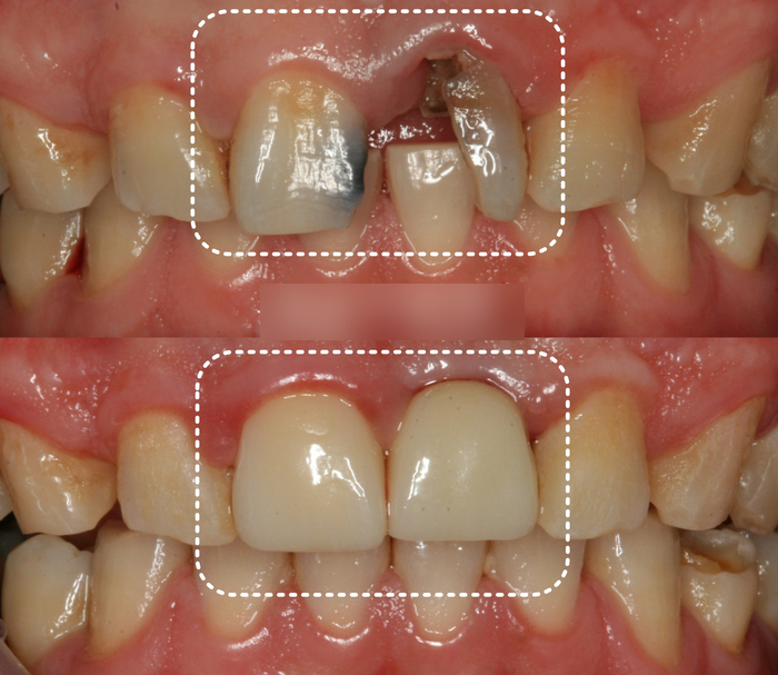 Treatment case image 11