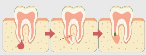 Treatment case image 1