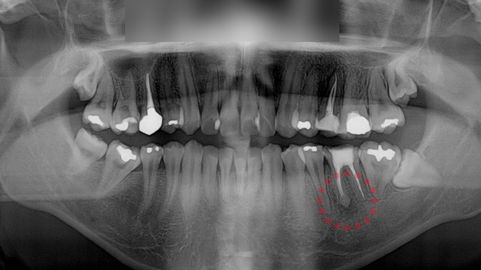 Treatment case image 2