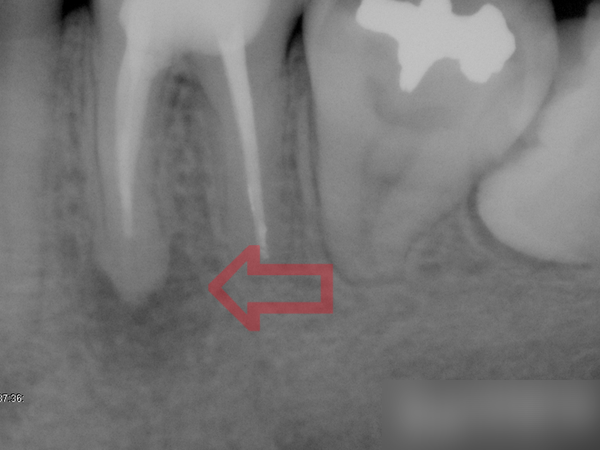 Treatment case image 3