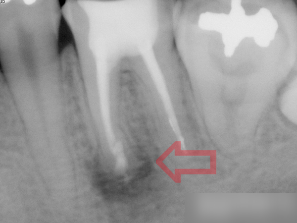 Treatment case image 4