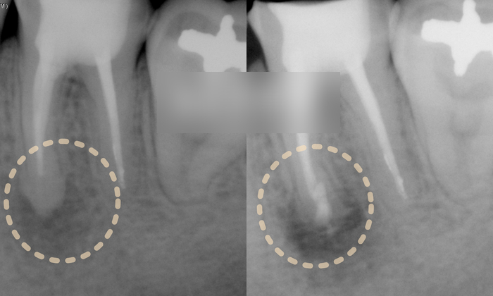 Treatment case image 6