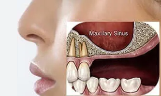 Treatment case image 1
