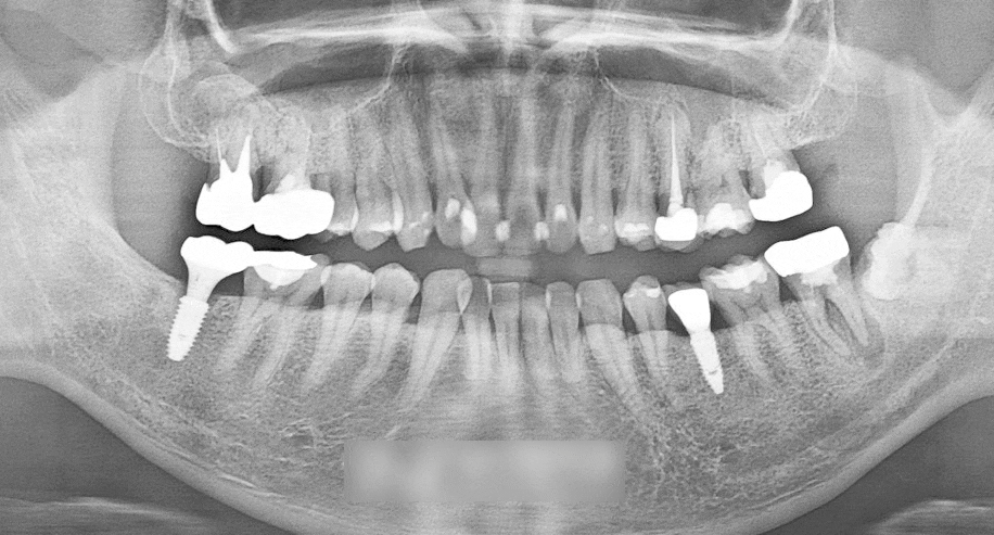 Treatment case image 2