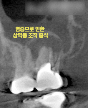 Treatment case image 3