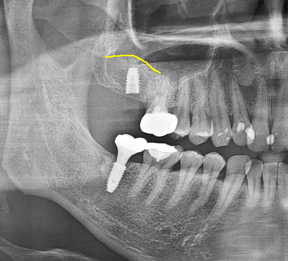 Treatment case image 4