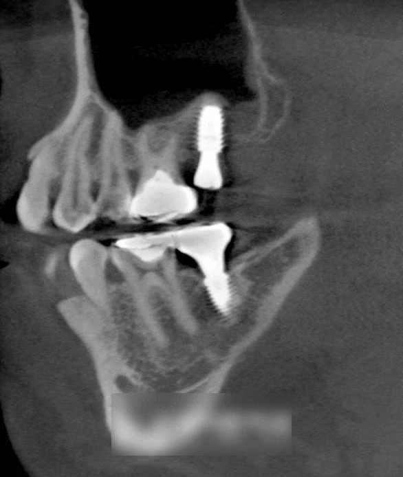 Treatment case image 5