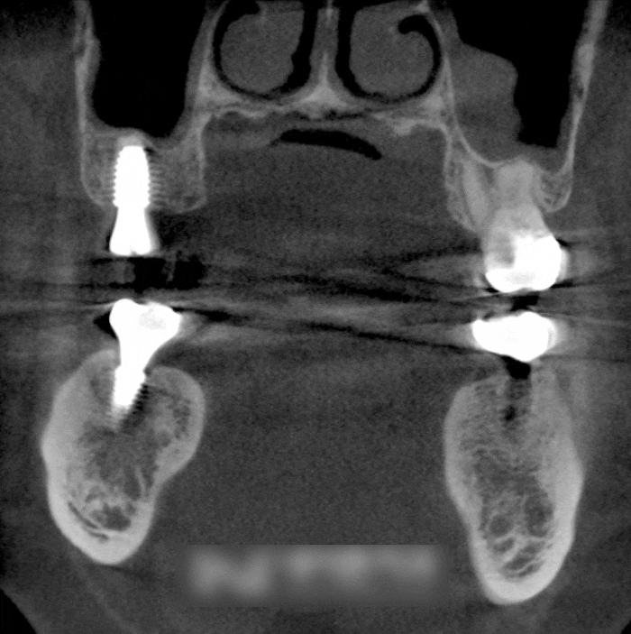 Treatment case image 6