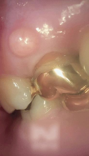 Treatment case image 1