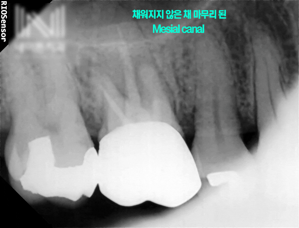Treatment case image 2