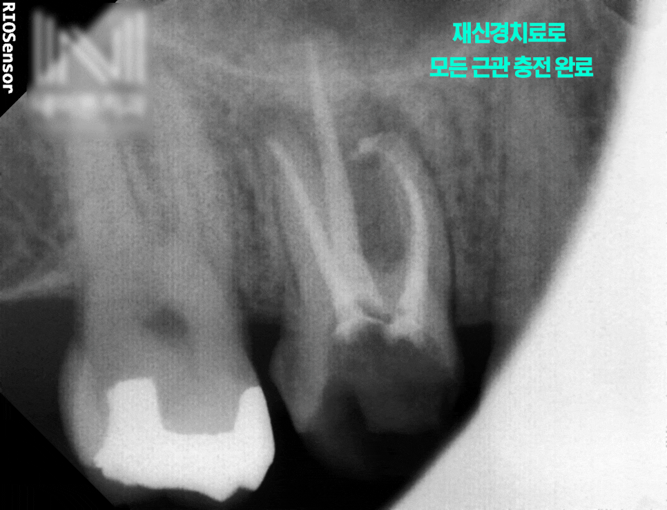 Treatment case image 6