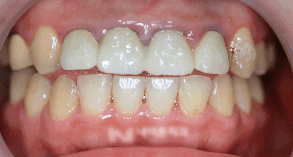 Treatment case image 1
