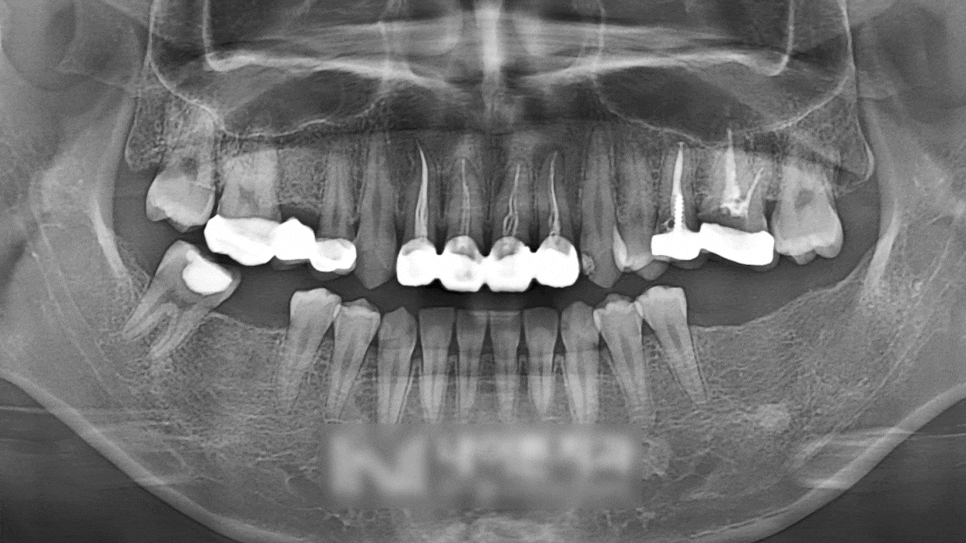 Treatment case image 2