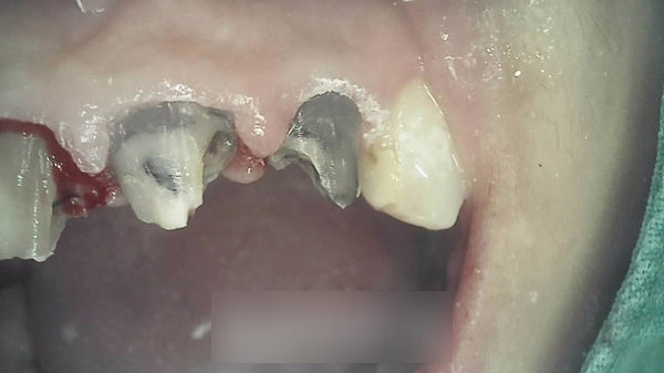 Treatment case image 5