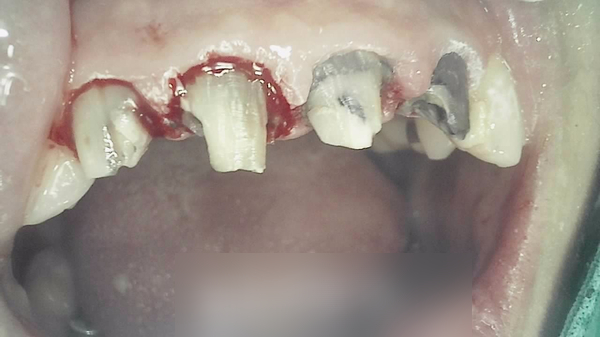 Treatment case image 6