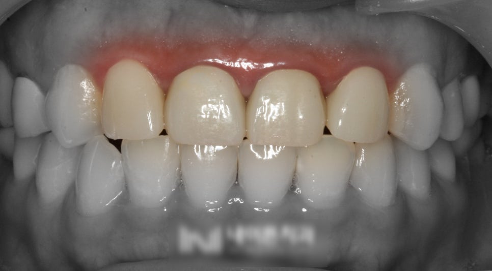 Treatment case image 8